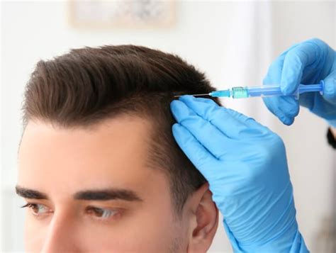 10 Proven Ways To Treat Hair Loss In Men Ostomy Lifestyle