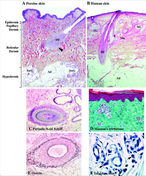 A B Comparative Histological Aspect Of Porcine A And Human B Skin