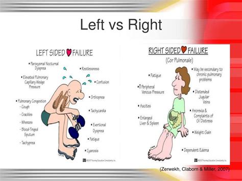 Heart Left Or Right Hypoplasia Of The Right Ventricle Radiology Key