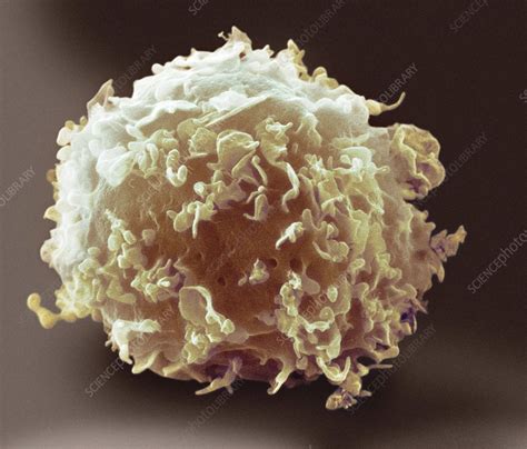 Monocyte White Blood Cell Sem Stock Image C0215394 Science