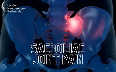 Sacroiliac Joint Pain London Neurosurgery Partnership Spine