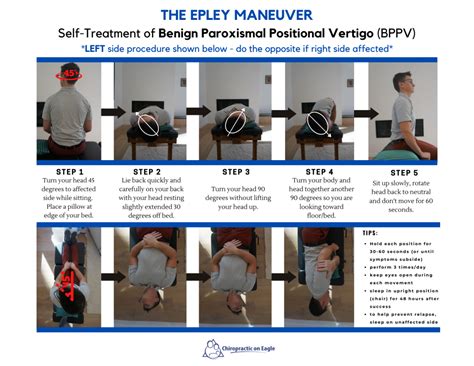 Epley Maneuver Patient Instructions