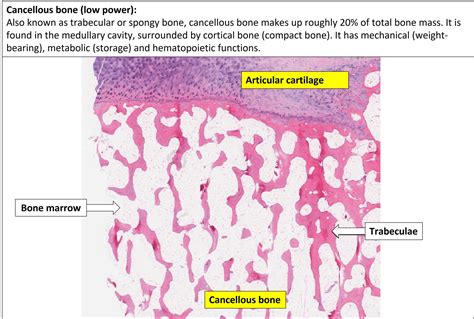 Bone Normal Histology Nus Pathweb Nus Pathweb