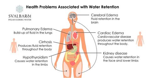 Water Fluid Retention Causes Symptoms Treatment For Edema 2023