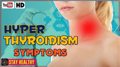 8 Hyperthyroidism Signs And Symptoms Youtube