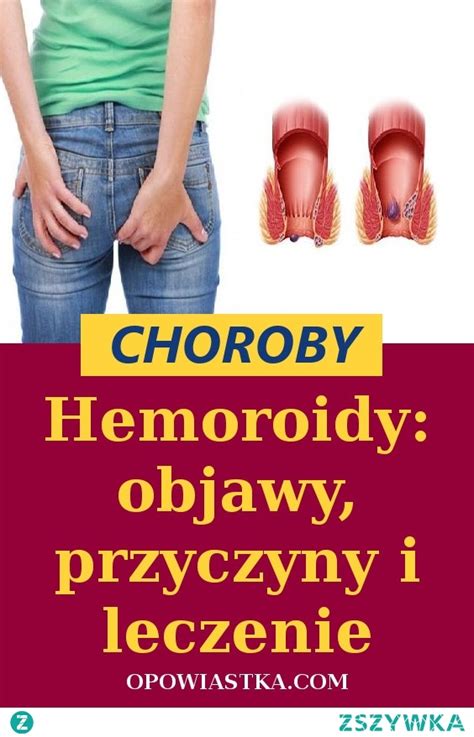 Hemoroidy Objawy