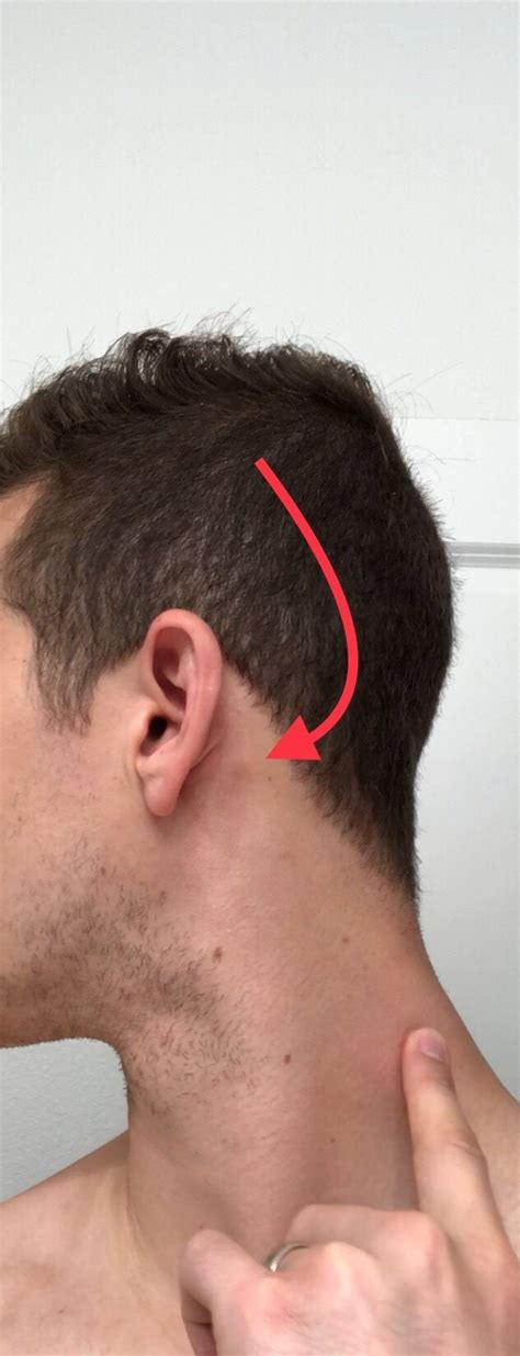 Small Lumplymph Node Behind Ear Askdocs