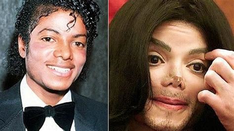 Deformado Relembre As Dezenas De Plásticas De Michael Jackson