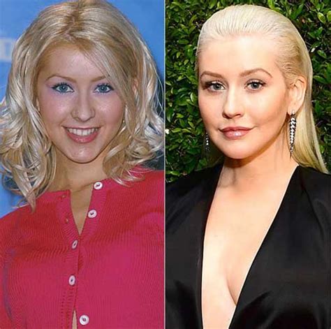 Christina Aguilera Plastic Surgery Boob Job Nose Job Lip Filler Botox