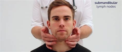 Lymphoreticular Examination Osce Guide Geeky Medics