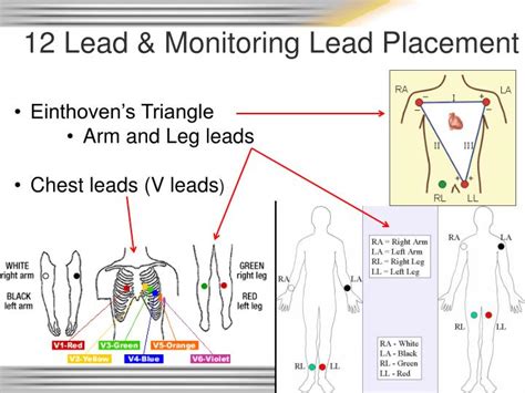 Ppt Rhythm And 12 Lead Ekg Review Powerpoint Presentation