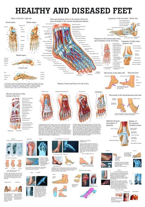 Foot Ankle Conditions Chart Poster Laminated Ubicaciondepersonascdmx