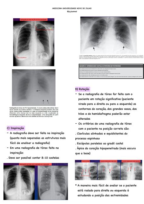 Solution Radiografia De T Rax Studypool