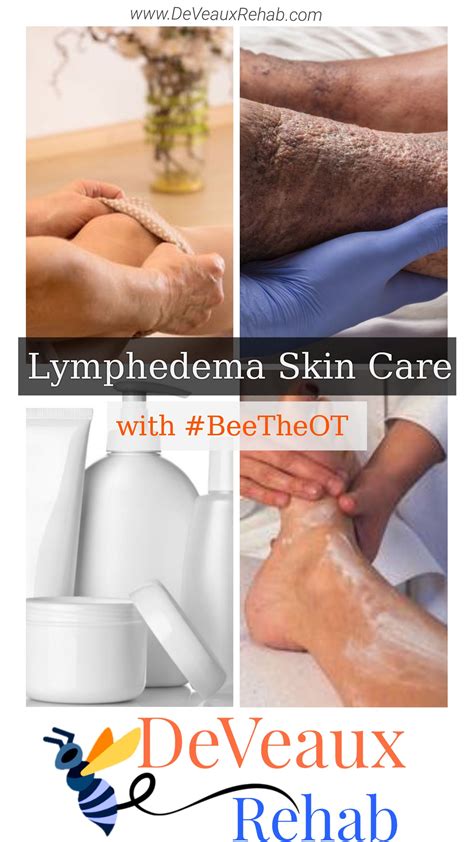 Lymphedema Skin Care Lymphedema Skin Care Online Therapy