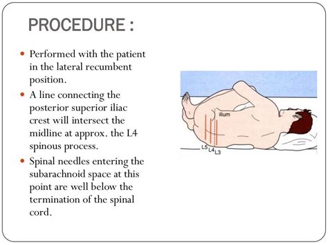 Lumbar Puncture And Bone Marrow Aspiration