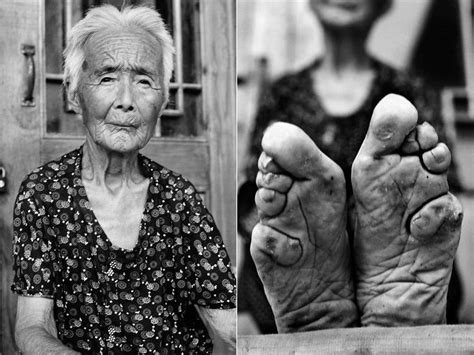 The Disturbing Tradition Of Foot Binding In China Social Junkie