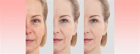 How Facial Rejuvenation Procedures Can Improve Aging Skin Johns