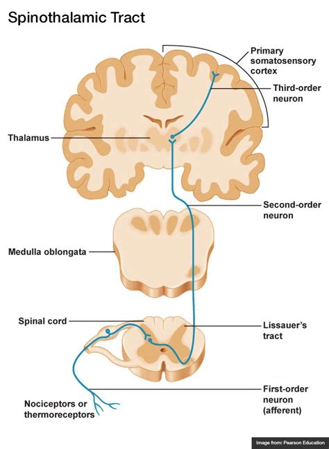 Spinothalamic Tract Differential Diagnosis Of