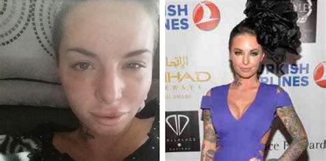 Photos Christy Mack Documents Her Recovery After Brutal Beating At Hands Of War Machine Laist
