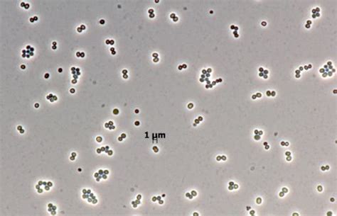 Staphylococcus Warneri E5 Dsm 30859 Bacdiveid14591