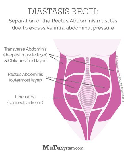 Diastasis Recti Core Connection Uk You May See A Coning Of Your Lower