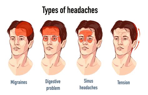 Can Cbd Help With Headaches Cbd Guide