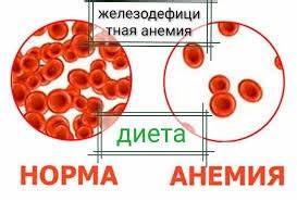 Диета при железодефицитная анемия Диета при анемии - Лучше не болеть - 39-я городская клиническая поликлиника Диета при анемии - Лучше не болеть - 39-я городская клиническая поликлиника Диета при железодефицитная анемия