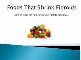 Photos of Can You Shrink Fibroid Tumors