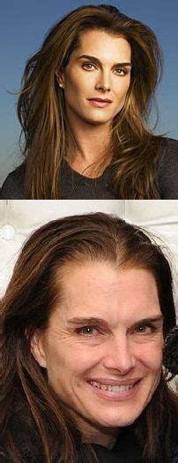 Brooke Shields Before And After