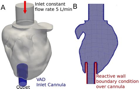 A Computational Domain Showing The Dilated Lv And The Lvad Inflow