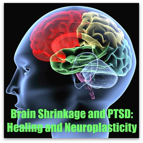 Brain Shrinkage And Ptsd — Peak Resilience