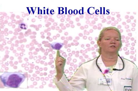 Pathology White Blood Cells Anatomy Guy