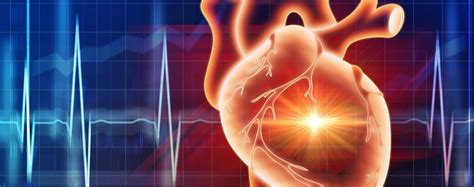 Insuffisance Cardiaque Fibrillation Auriculaire Ablater En Cas D