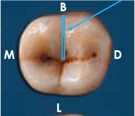 Tooth Morphology Maxillary Molars Flashcards Quizlet