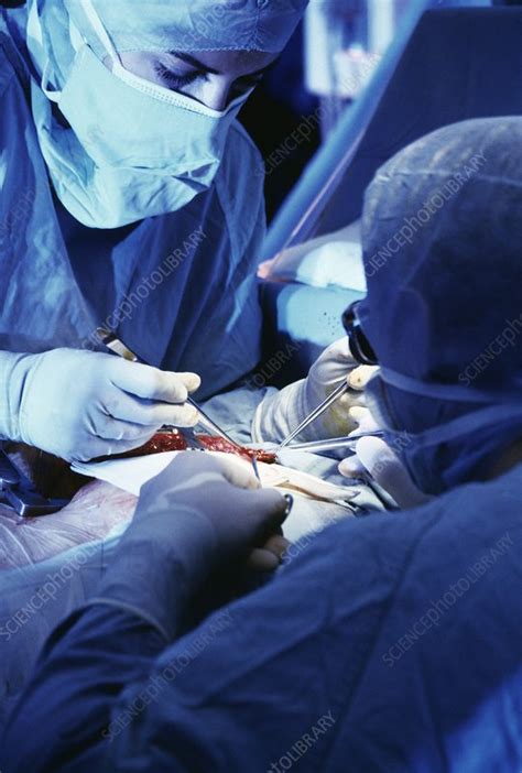 Heart Surgery Stock Image M5600413 Science Photo Library