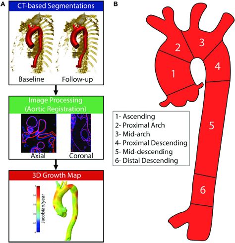 Schematic Representation Of The Steps Involved In The Vascular