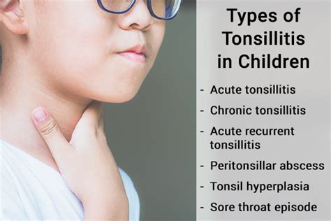 Tonsillitis In Children Types Causes Symptoms And Treatment