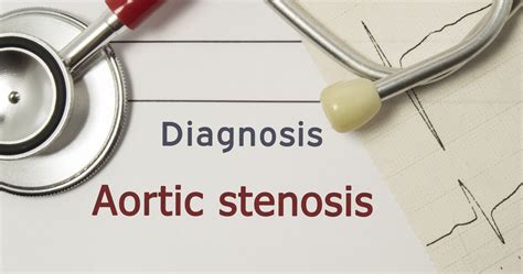 10 Key Facts About Aortic Stenosis Facty Health