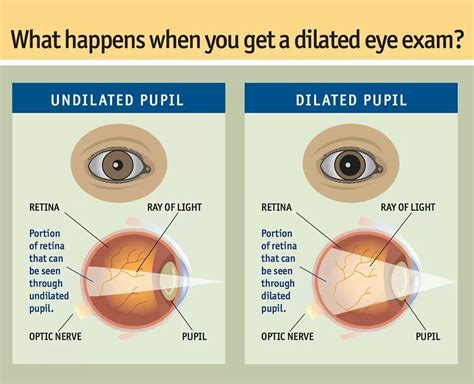Undilated Vs Dilated Pupil Eye Infographics Pinterest