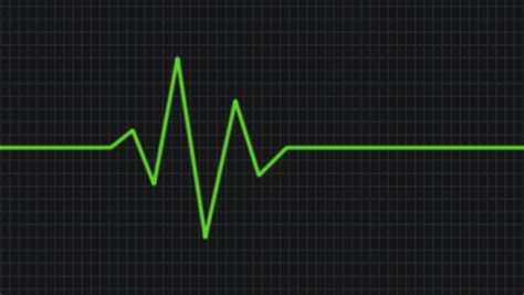 We did not find results for: Heart Beat Line in Green Stock Footage Video (100% Royalty-free) 34913455 | Shutterstock