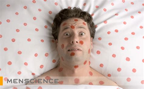 Stress And Mens Acne Breakouts Menscience