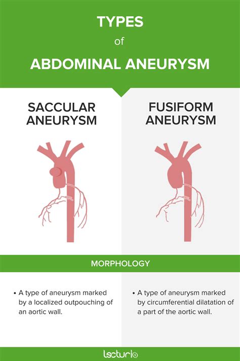 Learn About The Different Types Of The Abdominal Aortic Aneurysm And
