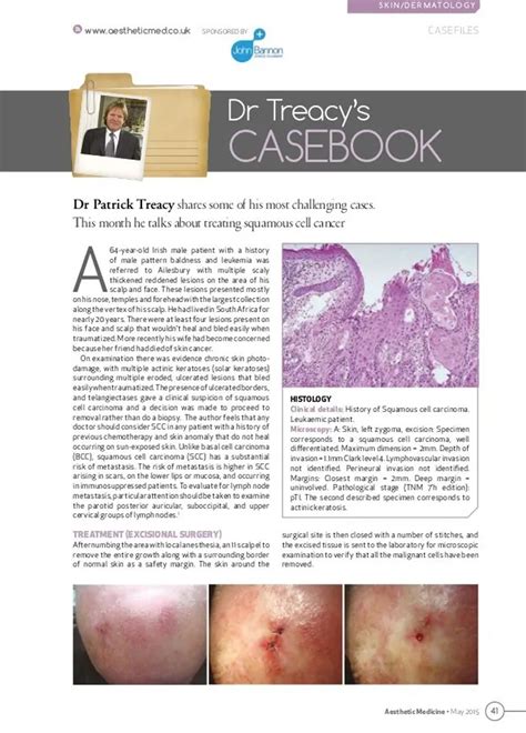 Squamous Cell Carcinoma Ailesbury Clinic