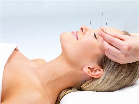 Relaxing Acupuncture Benefícios Da Acupuntura Acupuntura Tratamentos Naturais