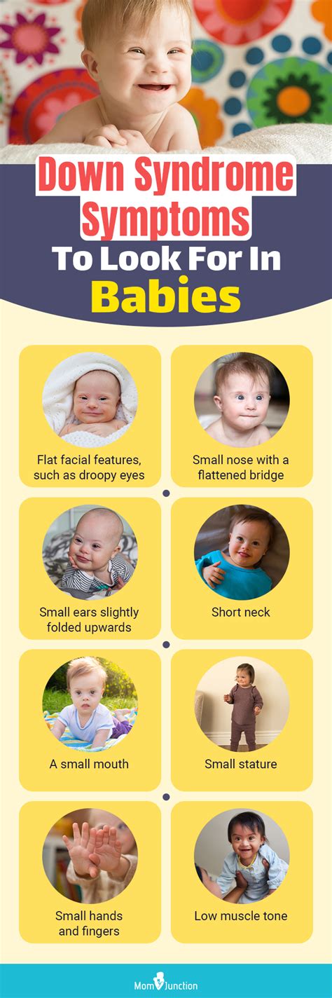 Down Syndrome In Babies Causes Symptoms And Treatment