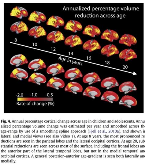 Brain Development And Aging Overlapping And Unique Patterns Of Change