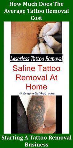 Likewise, if your skin scarred during your tattoo's healing period, the removal process won't erase those scars. 13 Best Tattoo Removal Prices images in 2013 | Tattoo ...