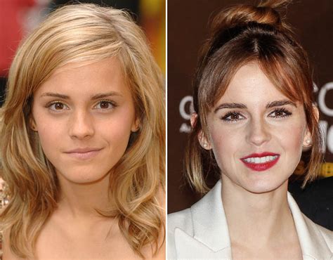 Emma Watson Eyebrows Celebrity Eyebrow Transformations Pictures