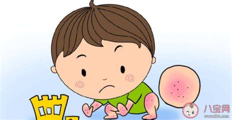 宝宝湿疹是怎么引起的 宝宝湿疹不能吃什么 八宝网