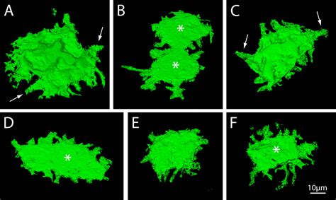 Molecular Vision Harrison Mol Vis 2016 2231 39 Figure 2